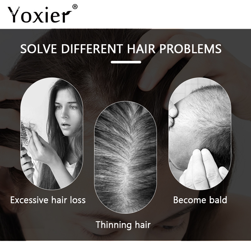 Chuyên Sâu Serum Kích Kem Ngăn - đánh giá và giá Hair Care Treatment