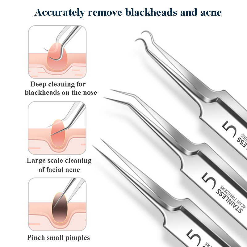 1Pcs Ingrown Hair Tweezers Acn - đánh giá và giá Hair Care Clinic