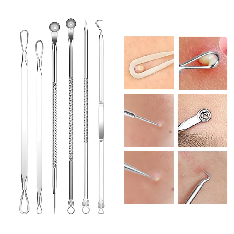 1Pcs Ingrown Hair Tweezers Acn - đánh giá và giá Hair Care Clinic