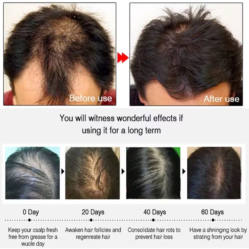 Fast Ginger Hair Growth Spray  - đánh giá và giá Hair Care Frizzy Hair
